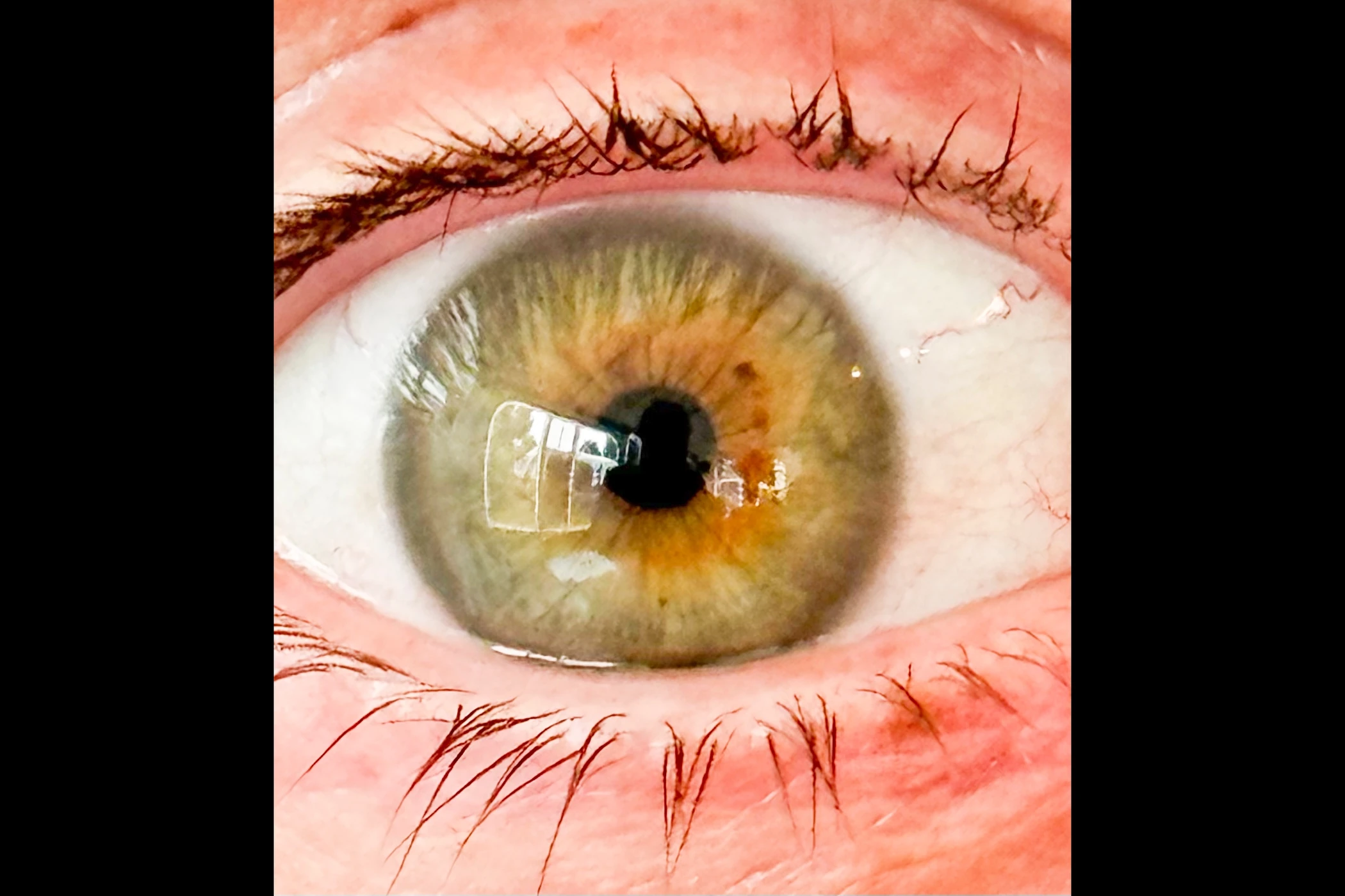 Unbearbeitetes Augenfoto, mit dem Handy aufgenommen